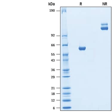 2 μg/lane of Recombinant SARS-CoV-2 Spike RBD mFc Chimera Protein, CF (Catalog # 10657-CV) was resolved with SDS-PAGE under reducing (R) and non-reducing (NR) conditions and visualized by Coomassie® Blue staining, showing bands at 55-65 kDa and 110-130 kDa, respectively.
