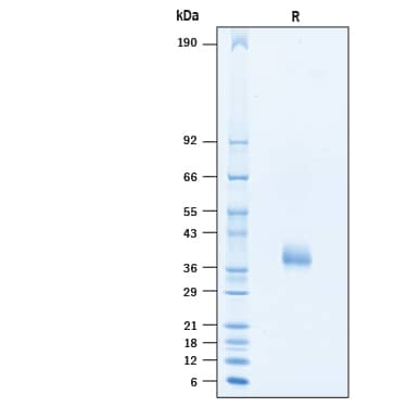 2 μg/lane of Recombinant SARS-CoV-2 Spike RBD (GCN4-IZ) His-tag (Catalog # 10659-CV) was resolved with SDS-PAGE under reducing (R) conditions and visualized by Coomassie® Blue staining, showing a band at 37-41 kDa.