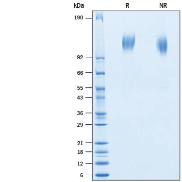 2 μg/lane of Recombinant BatCoV RaTG13 Spike S1 Subunit His-tag (Catalog # 10662-CV) was resolved with SDS-PAGE under reducing (R) and non-reducing (NR) conditions and visualized by Coomassie® Blue staining, showing bands at 113-127 kDa.