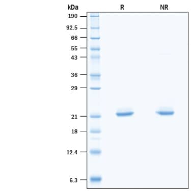 2 μg/lane of Recombinant SARS-CoV-2 NSP1 His-tag (Catalog # 10666-CV) was resolved with SDS-PAGE under reducing (R) and non-reducing (NR) conditions and visualized by Coomassie® Blue staining, showing bands at 20-23 kDa under reducing conditions.