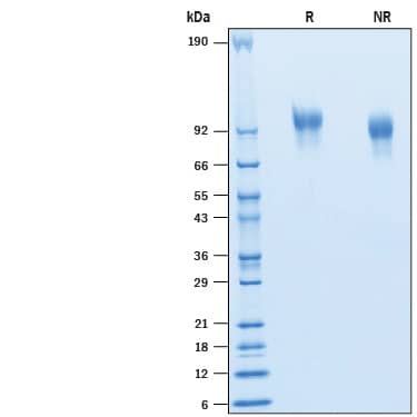 2 μg/lane of Recombinant Human PDGF R beta His-tag (Catalog # 10676-PR) was resolved with SDS-PAGE under reducing (R) and non-reducing (NR) conditions and visualized by Coomassie® Blue staining, showing bands at 93-103 kDa.