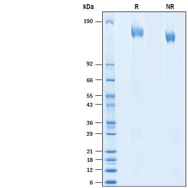 2 μg/lane of Recombinant SARS-CoV Spike His-tag (Catalog # 10683-CV) was resolved with SDS-PAGE under reducing (R) and non-reducing (NR) conditions and visualized by Coomassie® Blue staining, showing bands at 150-166 kDa.