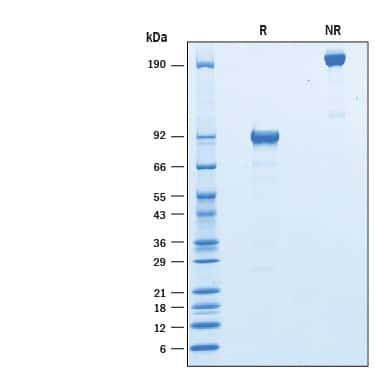 SDS-Page Natriuretic Peptide Receptor C [Unconjugated]