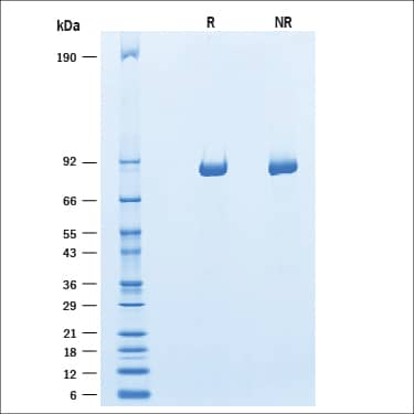 2 μg/lane of Recombinant Human alpha-L-Iduronidase / IDUA Protein (4119-GH) was resolved with SDS-PAGE under reducing (R) and non-reducing (NR) conditions and visualized by Coomassie® Blue staining, showing a band at ~83 kDa under reducing conditions.