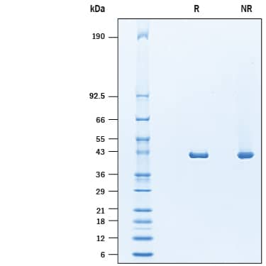 2 μg/lane of Recombinant Human ACAT1 (Catalog # 10242-AC) was resolved with SDS-PAGE under reducing (R) and non-reducing (NR) conditions and visualized by Coomassie® Blue staining, showing a band at 41 kDa under reducing conditions.