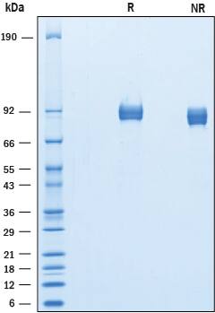 2 μg/lane of Recombinant Mouse ALCAM/CD166 was resolved with SDS-PAGE under reducing (R) and non-reducing (NR) conditions and visualized by Coomassie® Blue staining, showing bands at 81-95 kDa.