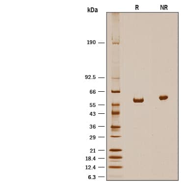 SDS-Page ALDH1A2 [Unconjugated]
