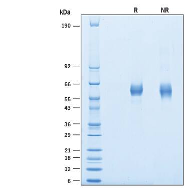 2 μg/lane of Recombinant Mouse APCDD1 His-tag (Catalog # 10141-AP) was resolved with SDS-PAGE under reducing (R) and non-reducing (NR) conditions and visualized by Coomassie® Blue staining, showing bands at 50-70 kDa.