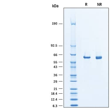 2 μg/lane of Recombinant Human Asparagine Synthetase/ASNS His-tag was resolved with SDS-PAGE under reducing (R) and non-reducing (NR) conditions and visualized by Coomassie® blue staining, showing a band at ~62 kDa under reducing conditions.