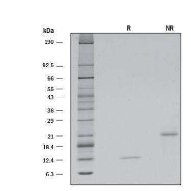 1 μg/lane of Recombinant Mouse Activin B was resolved with SDS-PAGE under reducing (R) and non-reducing (NR) conditions and visualized by silver staining, showing bands at 12 and 21 kDa, respectively.