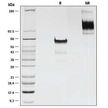 1 μg/lane of Recombinant Mouse Activin RIIB Fc Chimera was resolved with SDS-PAGE under reducing (R) and non-reducing (NR) conditions and visualized by silver staining, showing bands at 63 kDa and 110 kDa, respectively.