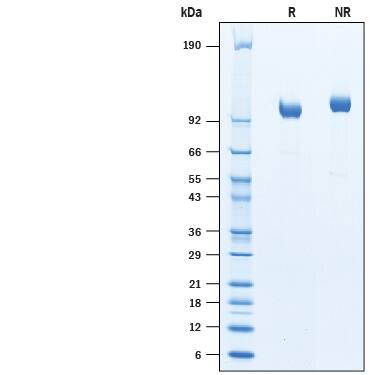 SDS-Page Aminopeptidase PILS/ARTS1 [Unconjugated]