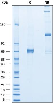 2 μg/lane of Recombinant Mouse Angiopoietin‑1 was resolved with SDS-PAGE under reducing (R) and non-reducing (NR) conditions and visualized by Coomassie® blue staining, showing bands at 59-75 kDa and oligomer, respectively.