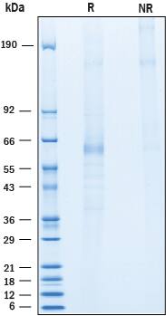 SDS-Page Angiopoietin-like Protein 1/ANGPTL1 [Unconjugated]