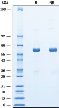 2 μg/lane of Recombinant Cynomolgus Monkey Angiopoietin‑like Protein 3/ANGPTL3 was resolved with SDS-PAGE under reducing (R) and non-reducing (NR) conditions and visualized by Coomassie Blue staining, showing bands at 56-65 kDa.