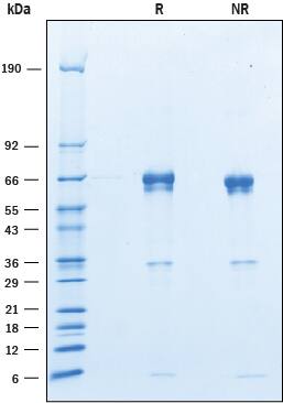 2 μg/lane of Recombinant Mouse Angiopoietin‑like Protein 3 was resolved with SDS-PAGE under reducing (R) and non-reducing (NR) conditions and visualized by Coomassie® Blue staining, showing bands at 59 - 71 kDa and 33 - 38 kDa.