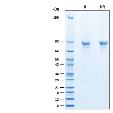 SDS-Page Angiopoietin-like protein 8/Betatrophin [Unconjugated]