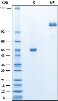 SDS-Page Angiopoietin-like protein 8/Betatrophin [Unconjugated]