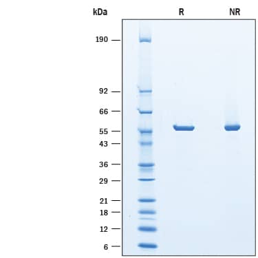 2 μg/lane of Recombinant Guinea Pig Asparaginase His-tag was resolved with SDS-PAGE under reducing (R) and non-reducing (NR) conditions and visualized by Coomassie® Blue staining, showing a band under reducing conditions at 57 kDa.