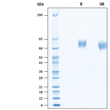 2 μg/lane of Recombinant Human Axl His-tag Protein (Catalog# 10448-AL) was resolved with SDS-PAGE under reducing (R) and non-reducing (NR) conditions and visualized by Coomassie® Blue staining, showing bands at 74-82 kDa.