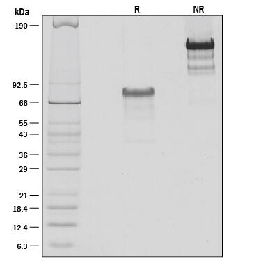 1 μg/lane of Recombinant Mouse PD-L1/B7-H1 Fc Chimera was resolved with SDS-PAGE under reducing (R) and non-reducing (NR) conditions and visualized by silver staining, showing bands at 79 kDa and 150 kDa, respectively.