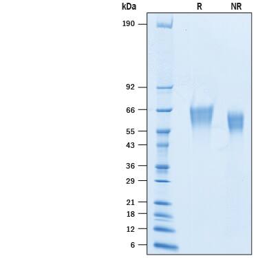 2 μg/lane of Recombinant Cynomolgus Monkey B7-2/CD86 His-tag (Catalog # 10300-B2) was resolved with SDS-PAGE under reducing (R) and non-reducing (NR) conditions and visualized by Coomassie® Blue staining, showing bands at 57-68 kDa.