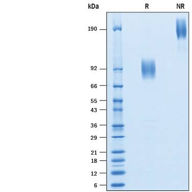 2 μg/lane of Biotinylated Recombinant Human B7-2/CD86 Fc Chimera Avi-tag (Catalog # AVI7625) was resolved with SDS-PAGE under reducing (R) and non-reducing (NR) conditions and visualized by Coomassie® Blue staining, showing bands at 87-101 kDa and 170-200 kDa, respectively.