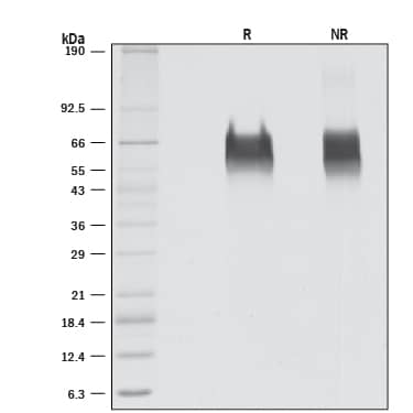1 μg/lane of Recombinant Human B7-H2 (Catalog # 8206-B7) was resolved with SDS-PAGE under reducing (R) and non-reducing (NR) conditions and visualized by silver staining, showing bands at 64.3 and 64.4 kDa, respectively.