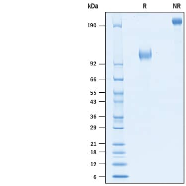 2 μg/lane of Biotinylated Recombinant Human B7-H3 (4Ig)/B7-H3b Fc Chimera Avi-tag (Catalog # AVI10381) was resolved with SDS-PAGE under reducing (R) and non-reducing (NR) conditions and visualized by Coomassie® Blue staining, showing bands at 104-120 kDa and 208-240 kDa, respectively.