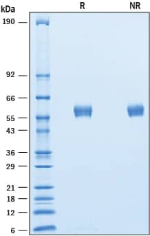 2 μg/lane of Recombinant Human BPIFB1 His-tag was resolved with SDS-PAGE under reducing (R) and non-reducing (NR) conditions and visualized by Coomassie® blue staining, showing bands at 55-61 kDa.