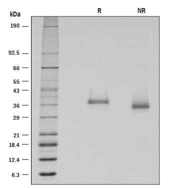 1 μg/lane of Recombinant Human BTN1A1/Butyrophilin was resolved with SDS-PAGE under reducing (R) and non-reducing (NR) conditions and visualized by silver staining, showing single bands at 37.2 kDa and 34.9 kDa, respectively.