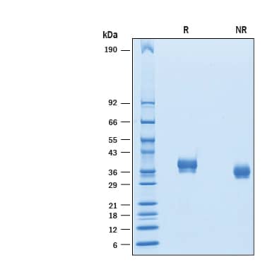 2 μg/lane of Biotinylated Recombinant Human BTN1A1/Buyrophilin His-tag Avi-tag (Catalog # AvI8467)was resolved with SDS-PAGE under reducing (R) and non-reducing (NR) conditions and visualized by Coomassie® blue staining, showing bands at 30-43 kDa.