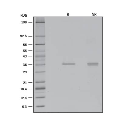 1 μg/lane of Recombinant Human CTRP4/C1qTNF4 (Catalog # 8357-TN) was resolved with SDS-PAGE under reducing (R) and non-reducing (NR) conditions and visualized by silver staining, showing R bands at 36.7 and 36.9 kDa, respectively.