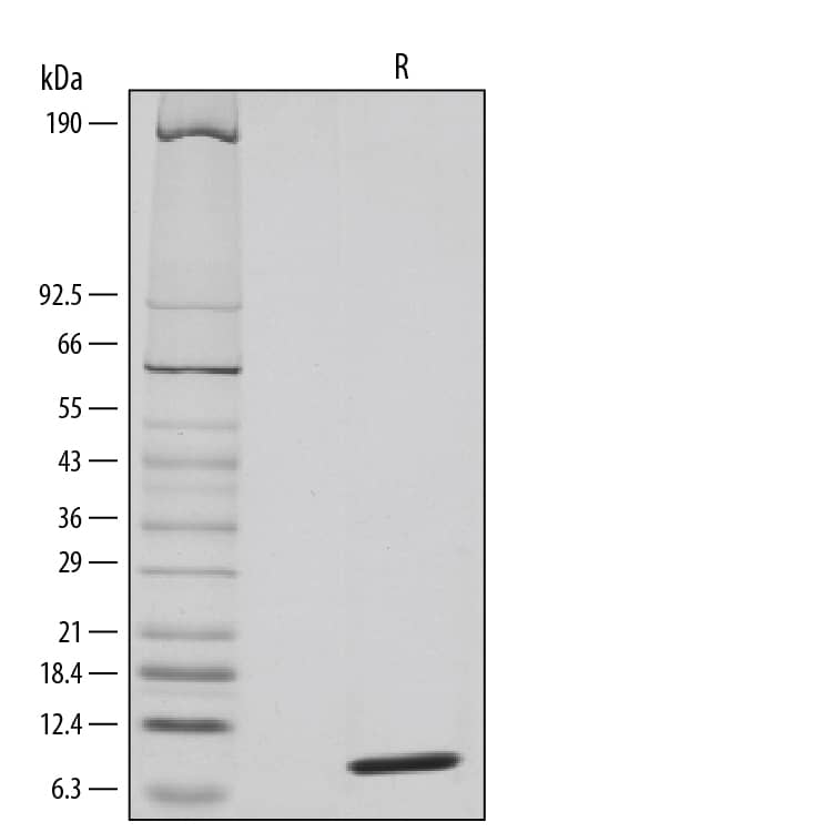 1 μg/lane of Recombinant Human CCL20/MIP-3 alpha  was resolved with SDS-PAGE under reducing (R) conditions and visualized by silver staining, showing a single band at 8 kDa.