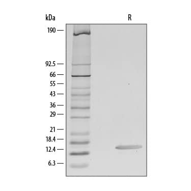 1 μg/lane of Recombinant Human CCL28 was resolved with SDS-PAGE under reducing (R) conditions and visualized by silver staining, showing a single band at 14 kDa.