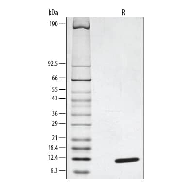 1 μg/lane of Recombinant Human CCL2/MCP-1 was resolved with SDS-PAGE under reducing (R) conditions and visualized by silver staining, showing a single band at 10 kDa.