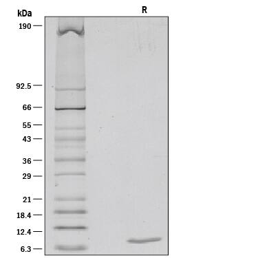 1 µg/lane of Recombinant Human CCL5/RANTES was resolved with SDS-PAGE under reducing (R) conditions and visualized by silver staining, showing a single band at 8 kDa.