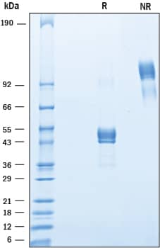 2 μg/lane of Recombinant Human CD11b/Integrin alpha M was resolved with SDS-PAGE under reducing (R) and non-reducing (NR) conditions and visualized by Coomassie® Blue staining, showing bands at 41-55 kDa and 80 - 110 kDa, respectively.