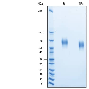 2 μg/lane of Recombinant Human CD155/PVR Hig-tag Avi-tag (Catalog # AVI2530) was resolved with SDS-PAGE under reducing (R) and non-reducing (NR) conditions and visualized by Coomassie® Blue staining, showing bands at 59-67 kDa.