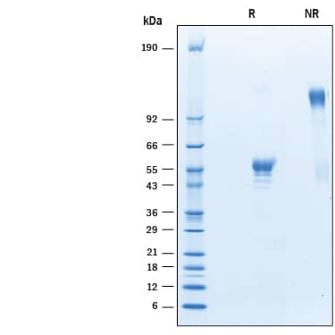 2 μg/lane of Recombinant Cynomolgus Monkey CD160 Fc Chimera (Catalog # 10197-CD) was resolved with SDS-PAGE under reducing (R) and non-reducing (NR) conditions and visualized by Coomassie® Blue staining, showing bands at 40-60 kDa and 80-120 kDa, respectively.