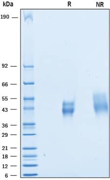 2 μg/lane of Recombinant Mouse CD200 was resolved with SDS-PAGE under reducing (R) and non-reducing (NR) conditions and visualized by Coomassie® blue staining, showing bands at 40-55 kDa.