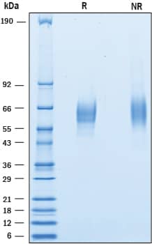 2 μg/lane of Recombinant Mouse CD200 R1 His-tag (Catalog # 10054-CD) was resolved with SDS-PAGE under reducing (R) and non-reducing (NR) conditions and visualized by Coomassie® Blue staining, showing bands at 50 - 70 kDa.