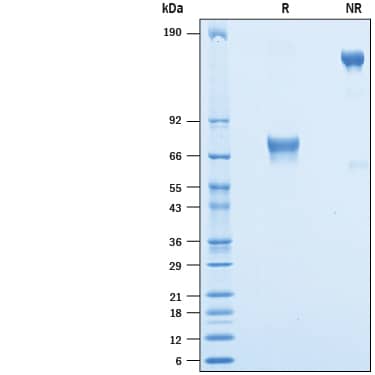 2 μg/lane of Biotinylated Recombinant Human CD25/IL-2R alpha Fc Chimera Avi-tag (Catlog # AVI1020) was resolved with SDS-PAGE under reducing (R) and non-reducing (NR) conditions and visualized by Coomassie® Blue staining, showing bands at 69-77 kDa and 140- 154 kDa, respectively.