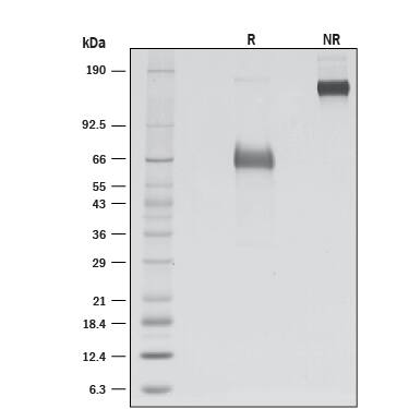 1 μg/lane of Recombinant Human CD2F/SLAMF9 Fc Chimera (Catalog # 8235-CD) was resolved with SDS-PAGE under reducing (R) and non-reducing (NR) conditions and visualized by silver staining, showing R bands at 60-70 kDa and NR bands at 150-160 kDa.