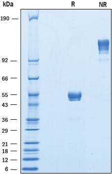 SDS-Page CD300b/LMIR5/CD300LB [Unconjugated]