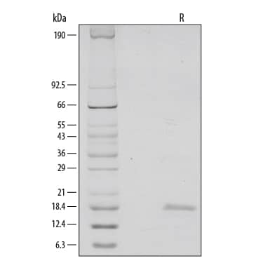 1 μg/lane of Recombinant Human CD40 Ligand/TNFSF5 (aa 108-261) was resolved with SDS-PAGE under reducing (R) conditions and visualized by silver staining, showing a single band at 18 kDa.