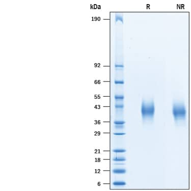 2 μg/lane of Recombinant Cynomolgus Monkey CD48/SLAMF2 His-tag (Catalog # 10399-CD) was resolved with SDS-PAGE under reducing (R) and non-reducing (NR) conditions and visualized by Coomassie® Blue staining, showing bands at 39-44 kDa.