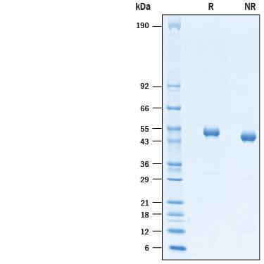 2 μg/lane of Recombinant Human CD4 (Catalog # 10327-CD) was resolved with SDS-PAGE under reducing (R) and non-reducing (NR) conditions and visualized by Coomassie® Blue staining, showing bands at 48-52 kDa.