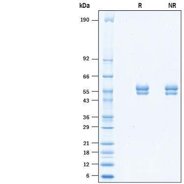 2 μg/lane of Recombinant Mouse CD4 His-tag Protein (Catalog # 10476-CD) was resolved with SDS-PAGE under reducing (R) and non-reducing (NR) conditions and visualized by Coomassie® Blue staining, showing bands at 50-60 kDa.