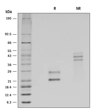 SDS-Page CD69 [Unconjugated]